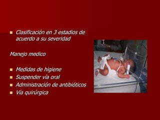  Clasificación en 3 estadios de
acuerdo a su severidad
Manejo medico
 Medidas de higiene
 Suspender vía oral
 Administración de antibióticos
 Vía quirúrgica
 