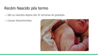 Recém Nascido pós termo
→ São os nascidos depois das 42 semanas de gestação.
→ Causas desconhecidas.
 