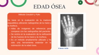 EDAD ÓSEA
Método Greulich y Pyle:
Se basa en la evaluación de la madurez
esquelética utilizando radiografías de la mano y
la muñeca.
Atlas de imágenes de referencia para
comparar con las radiografías del paciente.
Se centra en la evaluación de la osificación
de los huesos de la mano y la muñeca.
Es un método ampliamente utilizado y ha
sido una herramienta estándar en la
estimación de la edad ósea.
 