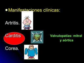 Manifestaciones clínicas: Artritis. Carditis Corea. Valvulopatías: mitral  y aórtica 