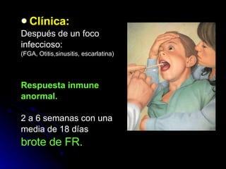 Clínica: Después de un foco infeccioso:  (FGA, Otitis,sinusitis, escarlatina)  Respuesta inmune anormal. 2 a 6 semanas con una media de 18 días brote de FR. 