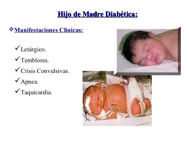 Hijo De Madre Diabetica Cuidados De Enfermeria