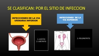 PEDIATRIA INFECCION URINARIA.pptx
