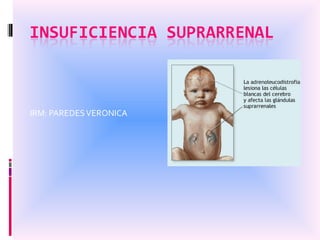 IRM: PAREDES VERONICA