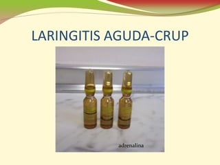 LARINGITIS AGUDA-CRUP




           adrenalina
 