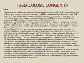 • CASO
• Niña de 20 días de edad que ingresa al Servicio de Neonatología por síndrome febril de 24 h de evolución sin foco
evidente. Nació por cesárea por falta de progresión, PN 3.050 g, edad gestacional de 40 semanas y Apgar 9/10.
Madre de 27 años, primigesta con embarazo controlado. Antecedente de internación en la semana 17 por
neumonía con derrame, medicada con ampicilina/sulbactam durante 10 días. Serologías para VIH, Chagas,
toxoplasmosis, VDRL negativas que recibió profilaxis antibiótica en el parto.
Se dio el alta conjunta a las 72 h de edad, con control de salud normal y pesquisa neonatal obligatoria: normal.
Reingresa a los 20 días de vida con peso 3.060 g, hiperextensión de cabeza, abdomen globuloso, doloroso a la
palpación profunda, hígado a 3 cm del reborde costal, polo de bazo, soplo sistólico intensidad 2/6 por estenosis
de ramas pulmonares.
Laboratorio de ingreso: Hto 31%, leucocitos 8.200/mm3 (neutrófilos 69%, linfocitos 25% y monocitos 5%),
plaquetas 50.000/mm3, tiempo de protrombina 38 seg, tiempo parcial de tromboplastina 53 seg, tiempo de
coagulación 73%, glucemia 102 mg%, calcio 8,1 mg%, Na 129 mEq/l, K 3,5 mEq/ l, proteína C-reactiva 1:16, EAB
pH 7,46,/ PO2 37/ PCO2 57/ bicarbonato 27/ exceso de base +2.2. LCR claro con leucocitos 3/mm3, glucosa 37
mg%, proteínas 0,50 gr/dl, Cl 102 mEq/l. Rx de tórax con infiltrado difuso a predominio derecho y Rx de abdomen
con regular distribución de aire. Con sospecha de sepsis neonatal se medicó con ampicilina y gentamicina.
En su evolución persiste febril con regular estado general y requerimiento de oxígeno. Laboratorio al 2° día de
internación: 5.200 leucocitos/mm3 (61% neutrófilos, 29% linfocitos y 10% monocitos), plaquetas 29.000/mm3,
TGO 117 UI, TGP 187 UI. Hemocultivos, urocultivo y cultivo de LCR sin desarrollo de bacterias comunes. A las 72 h
se repitió punción lumbar con cultivo bacteriano negativo y PCR para enterovirus negativos.
Ecografía abdominal: hepatomegalia difusa homogénea con ecoestructura conservadas. Vías biliares no dilatadas.
Adenopatías adyacentes al tronco celíaco y en hilio hepático (Figura 1). Ascitis libre. Esplenomegalia difusa
heterogénea con múltiples imágenes focales hipoecoicas de 2-5 mm de diámetro, que sugieren microabcesos
(Figura 2). Riñones y vías urinarias normales. Ecodoppler abdominal: venas suprahepáticas con flujo conservado.
Ecografía cerebral: normal. Fondo de ojo normal.
TUBERCULOSIS CONGENITA
 
