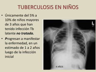TUBERCULOSIS EN NIÑOS
• Únicamente del 5% a
10% de niños mayores
de 3 años que han
tenido infección Tb
latente no tratada.
• Progresan a manifestar
la enfermedad, en un
estimado de 1 a 2 años
luego de la infección
inicial
4 AÑOS
 