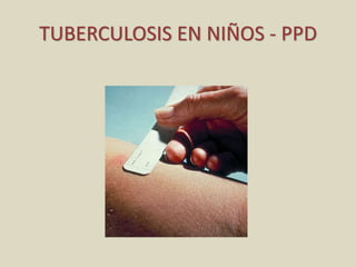 TUBERCULOSIS EN NIÑOS - PPD
 