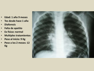• Edad: 1 año 9 meses
• Tos desde hace 1 año
• Diaforesis
• Falta de apetito
• Ex físico: normal
• Multiples tratamientos
• Peso al inicio: 9 Kg
• Peso a los 2 meses: 12
Kg
 