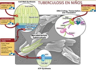 TUBERCULOSIS EN NIÑOS
 