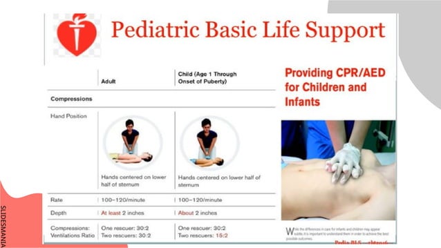 Pediatric-Basic-Life-Support-Jen-FO.pptx