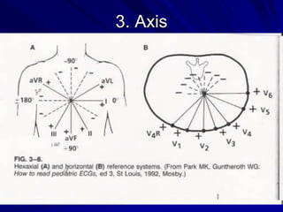3. Axis
 