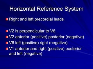 Horizontal Reference System
Right and left precordial leads
V2 is perpendicular to V6
V2 anterior (positive) posterior (negative)
V6 left (positive) right (negative)
V1 anterior and right (positive) posterior
and left (negative)
 