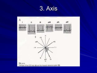 3. Axis
 