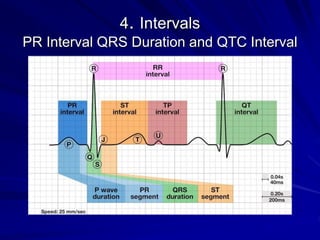 4. Intervals
PR Interval QRS Duration and QTC Interval
 