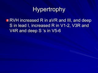 Hypertrophy
RVH increased R in aVR and III, and deep
S in lead I, increased R in V1-2, V3R and
V4R and deep S ‘s in V5-6
 