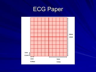 ECG Paper
 