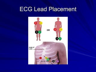 ECG Lead Placement
 