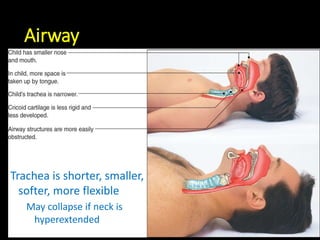 Airway
Trachea is shorter, smaller,
softer, more flexible
May collapse if neck is
hyperextended
 
