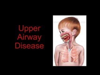 Upper
Airway
Disease
 