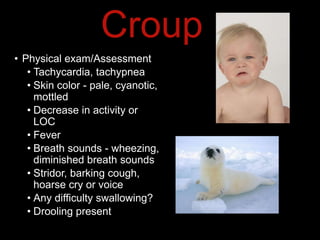 Croup
• Physical exam/Assessment
• Tachycardia, tachypnea
• Skin color - pale, cyanotic,
mottled
• Decrease in activity or
LOC
• Fever
• Breath sounds - wheezing,
diminished breath sounds
• Stridor, barking cough,
hoarse cry or voice
• Any difficulty swallowing?
• Drooling present
 
