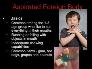 Aspirated Foreign Body
• Basics
• Common among the 1-3
age group who like to put
everything in their mouths
• Running or falling with
objects in mouth
• Inadequate chewing
capabilities
• Common items - gum, hot
dogs, grapes and peanuts
 