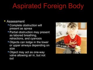 Assessment
Complete obstruction will
present as apnea
Partial obstruction may present
as labored breathing,
retractions, and cyanosis
Objects can lodge in the lower
or upper airways depending on
size
Object may act as one-way
valve allowing air in, but not
out
Aspirated Foreign Body
 