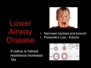 Lower
Airway
Disease
• Narrower trachea and bronchi
• Poiseulle’s Law - Edema
If radius is halved,
resistance increases
16x
 