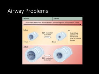 Airway Problems
 