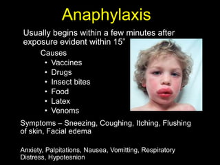 Causes
• Vaccines
• Drugs
• Insect bites
• Food
• Latex
• Venoms
Anaphylaxis
Usually begins within a few minutes after
exposure evident within 15”
Symptoms – Sneezing, Coughing, Itching, Flushing
of skin, Facial edema
Anxiety, Palpitations, Nausea, Vomitting, Respiratory
Distress, Hypotesnion
 