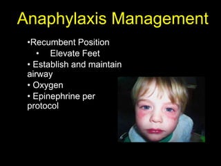 •Recumbent Position
• Elevate Feet
• Establish and maintain
airway
• Oxygen
• Epinephrine per
protocol
Anaphylaxis Management
 