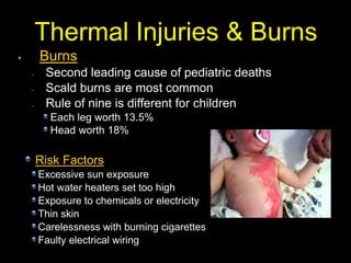 Burns
Second leading cause of pediatric deaths
Scald burns are most common
Rule of nine is different for children
Each leg worth 13.5%
Head worth 18%
Thermal Injuries & Burns
Risk Factors
Excessive sun exposure
Hot water heaters set too high
Exposure to chemicals or electricity
Thin skin
Carelessness with burning cigarettes
Faulty electrical wiring
 