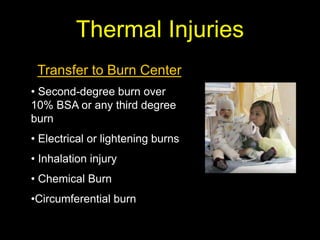 Thermal Injuries
Transfer to Burn Center
• Second-degree burn over
10% BSA or any third degree
burn
• Electrical or lightening burns
• Inhalation injury
• Chemical Burn
•Circumferential burn
 