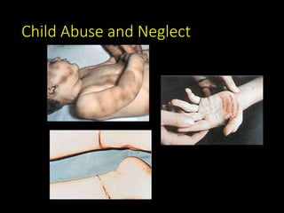 Child Abuse and Neglect
 
