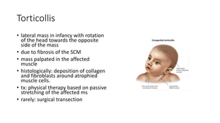 Torticollis
• lateral mass in infancy with rotation
of the head towards the opposite
side of the mass
• due to fibrosis of the SCM
• mass palpated in the affected
muscle
• histologically: deposition of collagen
and fibroblasts around atrophied
muscle cells.
• tx: physical therapy based on passive
stretching of the affected ms
• rarely: surgical transection
 