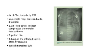 • dx of CDH is made by CXR
• immediate respi distress due to
3 factors:
• 1. air filled bowel in chest
compresses the mobile
mediastinum
• 2. pulmo htn
• 3. lung on the affected side is
often hypoplastic
• overall mortality: 50%
 