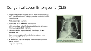 Congenital Lobar Emphysema (CLE)
• progressive hyperexpansion of one or more lobes of the lung--
shifts the mediastinum to the opposite side and compromises
the other lung
• life-threatening in newborn
• upper lobes (L>R)--R Middle --lower lobes
• mild respi distress to full-fledged respi failure w/ tachypnea,
dyspnea, cough and late cyanosis.
• pathogneumonic: hyperexpanded hemithorax on the
ipsilateral side
• chest xray: hyperlucent affected lobe w/ adjacent lobar
compression and atelectasis
• tx: resection of the affected lobe: open or thorascopic after
several months
• prognosis: excellent
 
