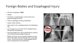 Foreign Bodies and Esophageal Injury
• MC obj in esophagus is COIN
• toddler
• 3 locations: cricopharyngeus, area of aortic arch,
gastroesophageal junction
• initial sx: dysphagia, drooling, dehydration
• cough, stridor, wheezes
• chest xray for coin, esophagoscopy for nonradiopaque
obj
• coin at upper eso in less than 24 hrs: Margill forceps
during direct laryngoscopy
• sharp obj (safety pins): injure underlying eso, extreme
care of extraction plus diligent follow up
• battery: strictures, can be surgical emergency as neg
pole of the battery directly damages the surrounding
tissue-- local tissue necrosis--treoesophageal fistula,
aortic exsanguination and mediatinitis
 