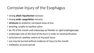 Corrosive Injury of the Esophagus
• strong alkali: liquefaction necrosis
• strong acids: coagulation necrosis
• strictures at anatomic narrowed areas of eso
• drooling, unable to swallow saliva
• dx: PE of the mouth and endoscopy w/ flexible or rigid esophagoscope
• endoscope only at the level of the burn in order to avoid perforation
• early barium swallow: extent of mucosal injury
• eso may be burned without evidence of injury to the mouth.
• antibiotics at acute period
 