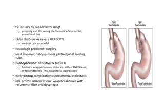 • tx: initially by conservative mngt
• propping and thickening the formula w/ rice cereal,
prone head pos
• older children w/ severe GERD: PPI
• medical tx is successful
• neurologic problems: surgery
• least invasive: nasojejunal or gastrojejunal feeding
tube.
• fundoplication: definitive tx for GER
• fundus is wrapped around distal eso either 360 (Nissen)
or lesser degrees (Thal Toupet) via laporoscopy
• early postop complications: pneumonia, atelectasis
• late postop complications: wrap breakdown with
recurrent reflux and dysphagia
 