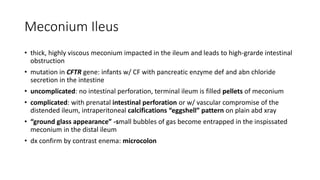 Meconium Ileus
• thick, highly viscous meconium impacted in the ileum and leads to high-grarde intestinal
obstruction
• mutation in CFTR gene: infants w/ CF with pancreatic enzyme def and abn chloride
secretion in the intestine
• uncomplicated: no intestinal perforation, terminal ileum is filled pellets of meconium
• complicated: with prenatal intestinal perforation or w/ vascular compromise of the
distended ileum, intraperitoneal calcifications “eggshell” pattern on plain abd xray
• “ground glass appearance” -small bubbles of gas become entrapped in the inspissated
meconium in the distal ileum
• dx confirm by contrast enema: microcolon
 