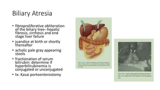 Biliary Atresia
• fibroproliferative obliteration
of the biliary tree--hepatic
fibrosis, cirrhosis and end
stage liver failure
• juandice at birth or shortly
thereafter
• acholic pale gray appearing
stools
• fractionation of serum
bilirubin: determine if
hyperbilirubinemia is
conjugated or unconjugated
• tx: Kasai portoenterostomy
 
