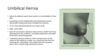 Umbilical Hernia
• failure of umbilical ring to close results in a central defect in linea
alba
• covered by normal umbilical skin and subcutaneous tissue,
fascial defect allows protrusion of abdominal contents.
• <1 cm: close spontaneously by 4 to 5 years of life
• large : early repair
• signs of incarceration: abd pain, bilious emesis, tender hard mass
protuding from the umbilicus--immediate exploration and repair
of hernia to avoid strangulation
• outpatient: general anethesia, small curving incision at skin
crease of the umbilicus is made--sac is dissected free from the
overlying skin--absorbable, interrupted suture at transverse
plane--skin is closed using subcuticular sutures
 