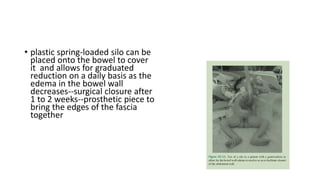 • plastic spring-loaded silo can be
placed onto the bowel to cover
it and allows for graduated
reduction on a daily basis as the
edema in the bowel wall
decreases--surgical closure after
1 to 2 weeks--prosthetic piece to
bring the edges of the fascia
together
 