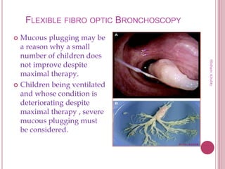 FLEXIBLE FIBRO OPTIC BRONCHOSCOPY
 Mucous plugging may be
a reason why a small
number of children does
not improve despite
maximal therapy.
 Children being ventilated
and whose condition is
deteriorating despite
maximal therapy , severe
mucous plugging must
be considered.
HishamAlrabty
 