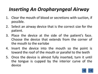 Inserting An Oropharyngeal Airway
1. Clear the mouth of blood or secretions with suction, if
possible.
2. Select an airway device that is the correct size for the
patient.
3. Place the device at the side of the patient’s face.
Choose the device that extends from the corner of
the mouth to the earlobe
4. Insert the device into the mouth so the point is
toward the roof of the mouth or parallel to the teeth
5. Once the device is almost fully inserted, turn it until
the tongue is cupped by the interior curve of the
device
 