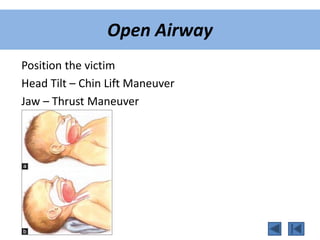 Position the victim
Head Tilt – Chin Lift Maneuver
Jaw – Thrust Maneuver
Open Airway
 