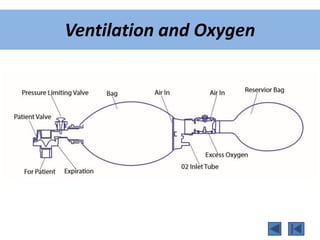 Ventilation and Oxygen
 