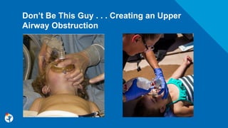 Don’t Be This Guy . . . Creating an Upper
Airway Obstruction
 