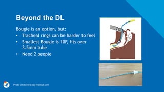 Beyond the DL
Bougie is an option, but:
• Tracheal rings can be harder to feel
• Smallest Bougie is 10F, fits over
3.5mm tube
• Need 2 people
Photo credit:www.bay-medical.com
 